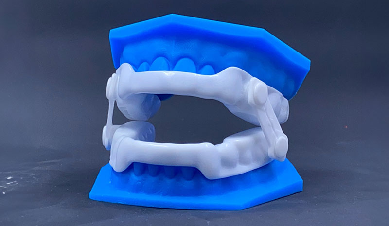 TMJ Sleep Appliances in St. Louis